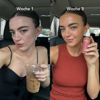 Medivitas Glow Drops™ - Natürliche Bräune ohne UV