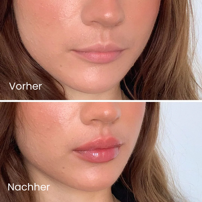 Extreme Lip Plumper