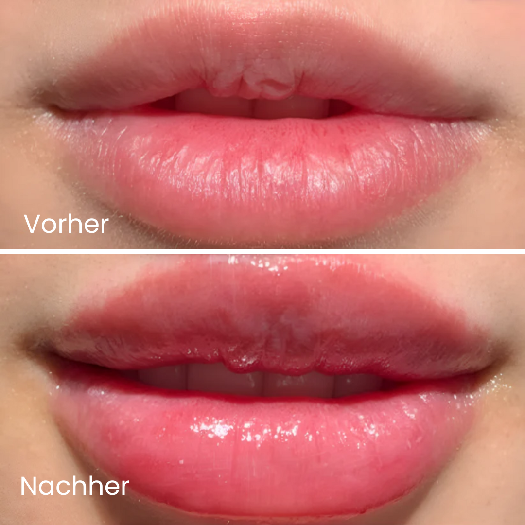 Extreme Lip Plumper
