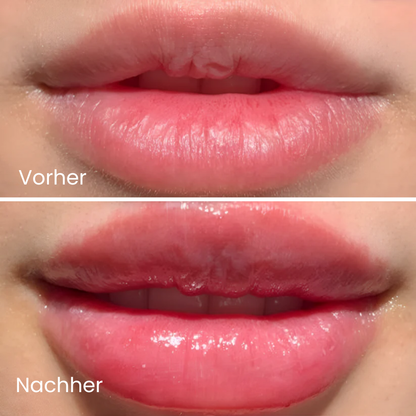 Extreme Lip Plumper