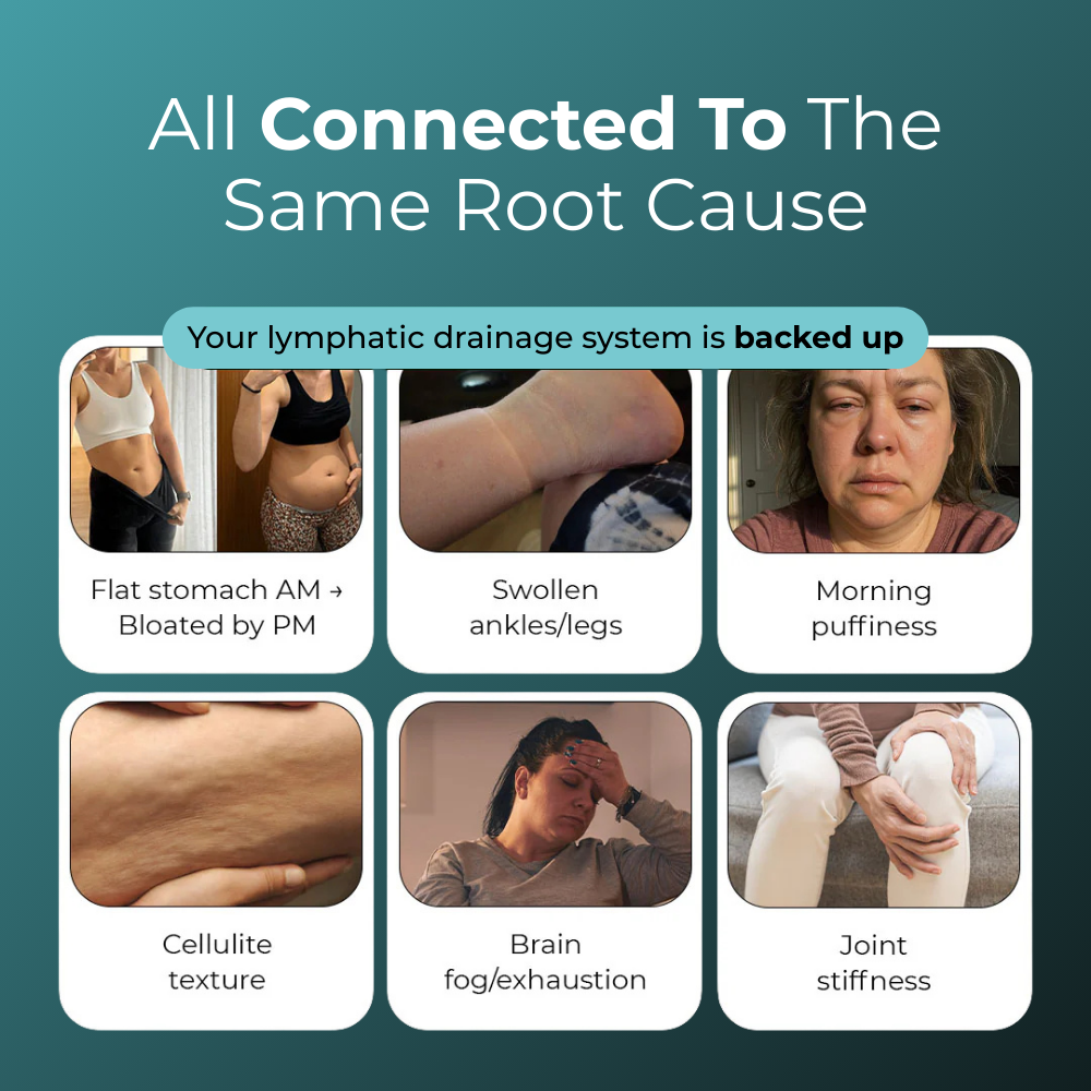Lymphatic Drainage Capsules by Auralea™