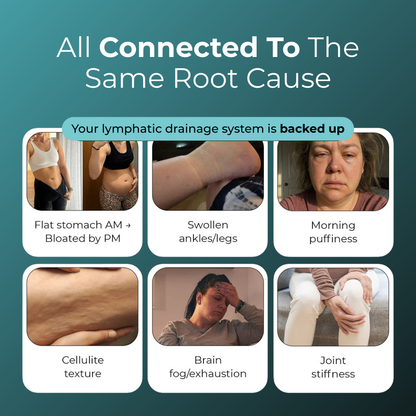 Lymphatic Drainage Capsules by Auralea™