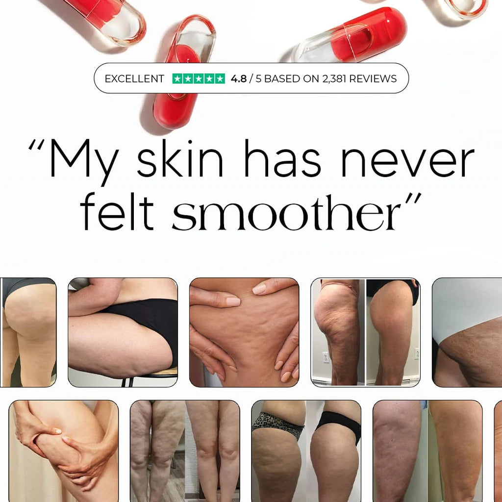 Anti-Cellulite & Lipedema Capsules by Auralea™