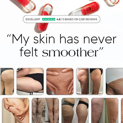 Anti-Cellulite & Lipedema Capsules by Auralea™